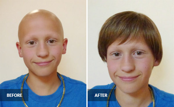 cancer foundations