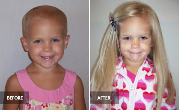 cancer charities